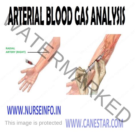 gas analyzer drawing|Blood Gas Test: Purpose, Procedure, and Side .